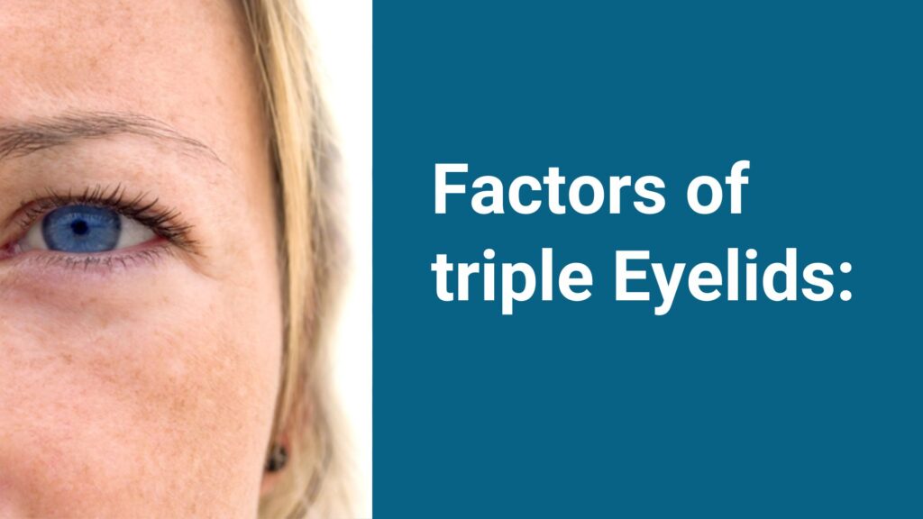Factors of triple Eyelids