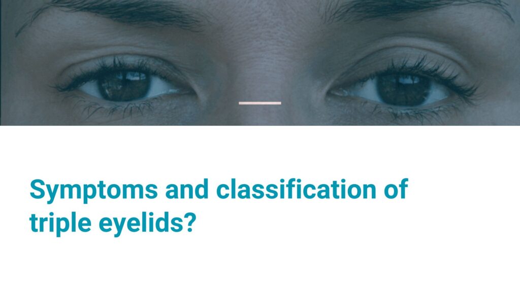 Symptoms and classification of triple eyelids